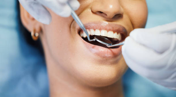 Best Dentist for Dental Trauma  in Saw Creek, PA